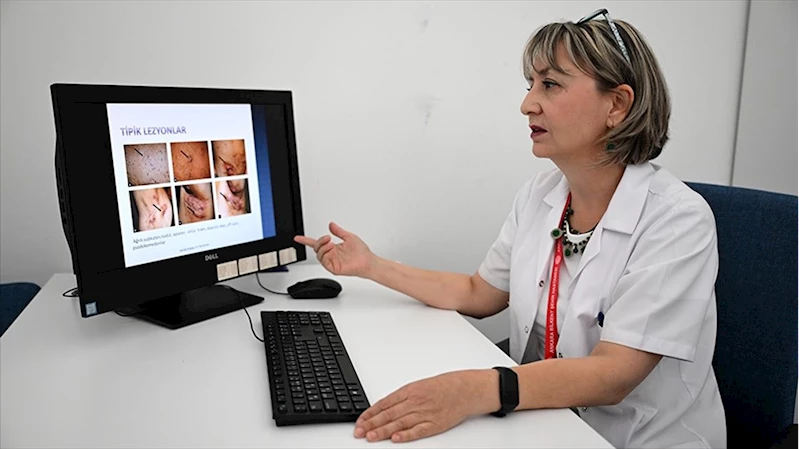 Derideki ağrılı nodüller 