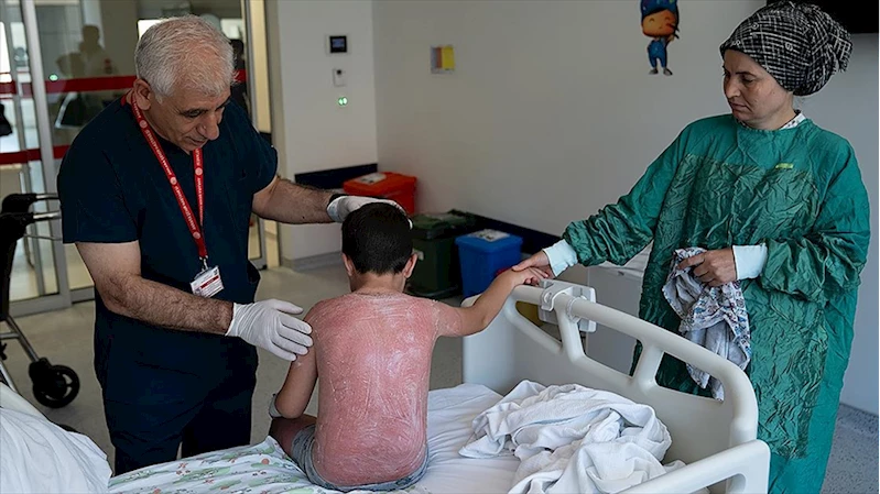 Güneşte 4 saat kalan çocuk, ikinci derece yanıkla hastanelik oldu